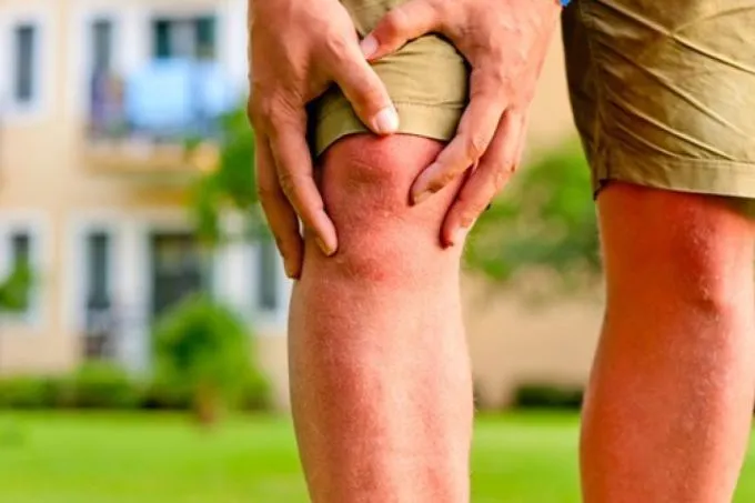 Gối Sưng Đau: Hiểu Đúng Nguyên Nhân, Tránh Nguy Cơ Teo Cơ Vận Động