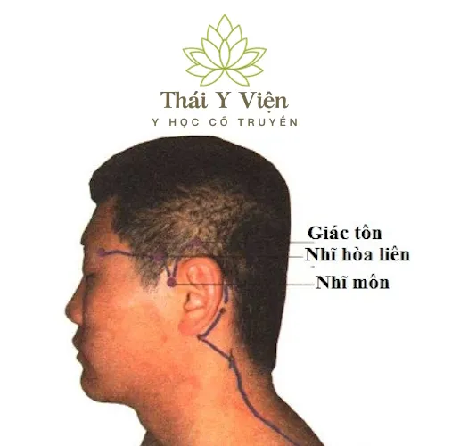 Huyệt Huyệt Nhĩ Môn (TE21)