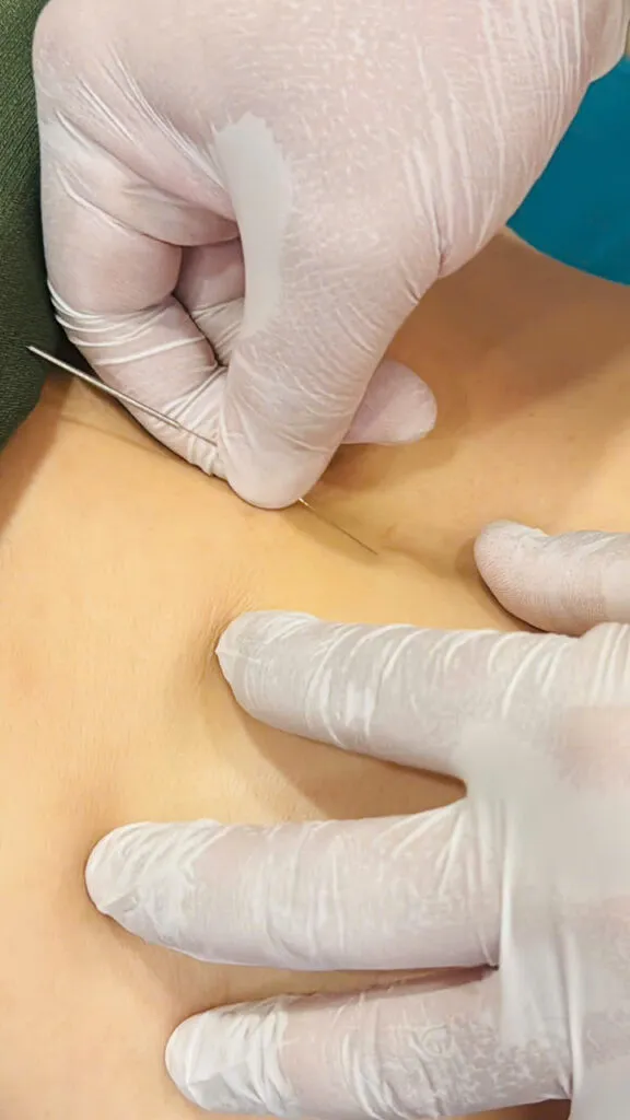 Hình ảnh điều trị tại Thái Y Viện 7