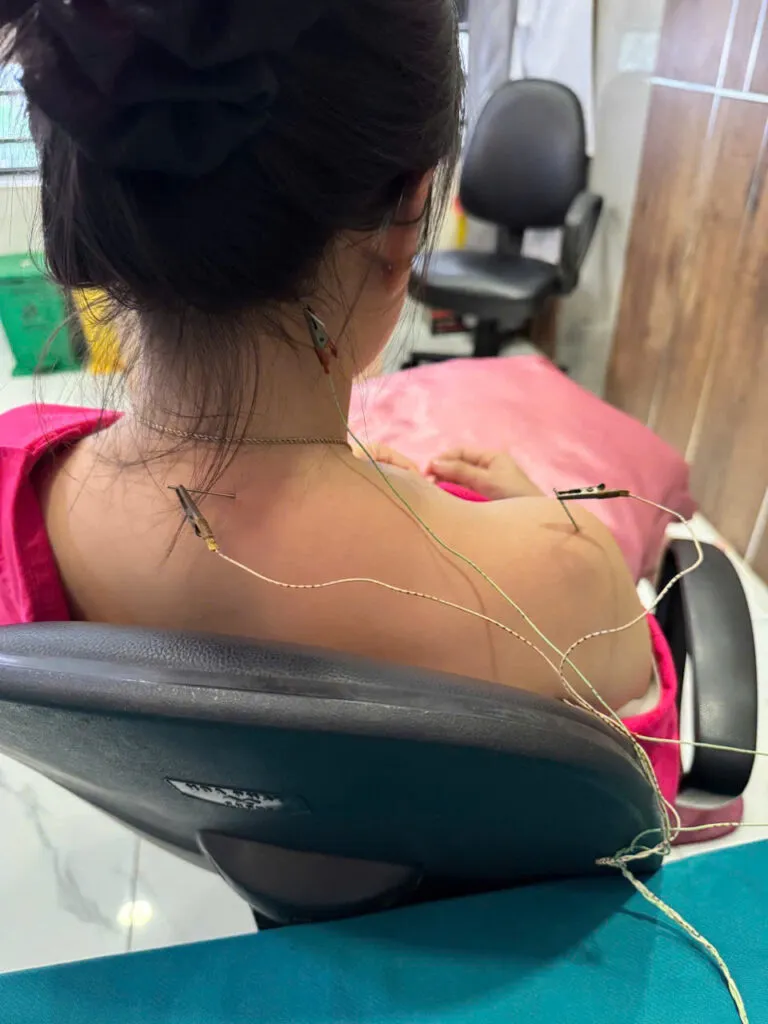Điều trị thoái hóa cột sống cổ tại Thái Y Viện